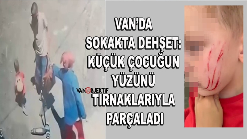 Van’da sokakta dehşet: Küçük çocuğun yüzünü tırnaklarıyla parçaladı